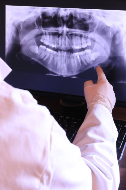 Best Emergency Treatment for Dental Infections or Abscesses in Country Club Estates, GA
